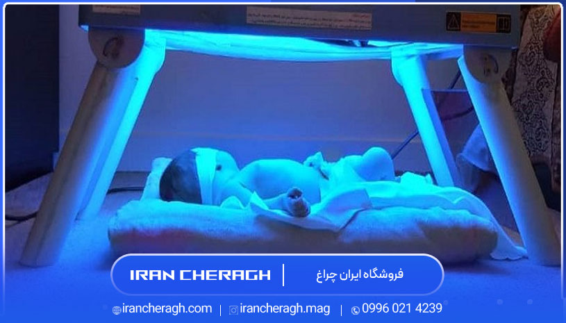 لامپ فلورسنت برای زردی نوزاد